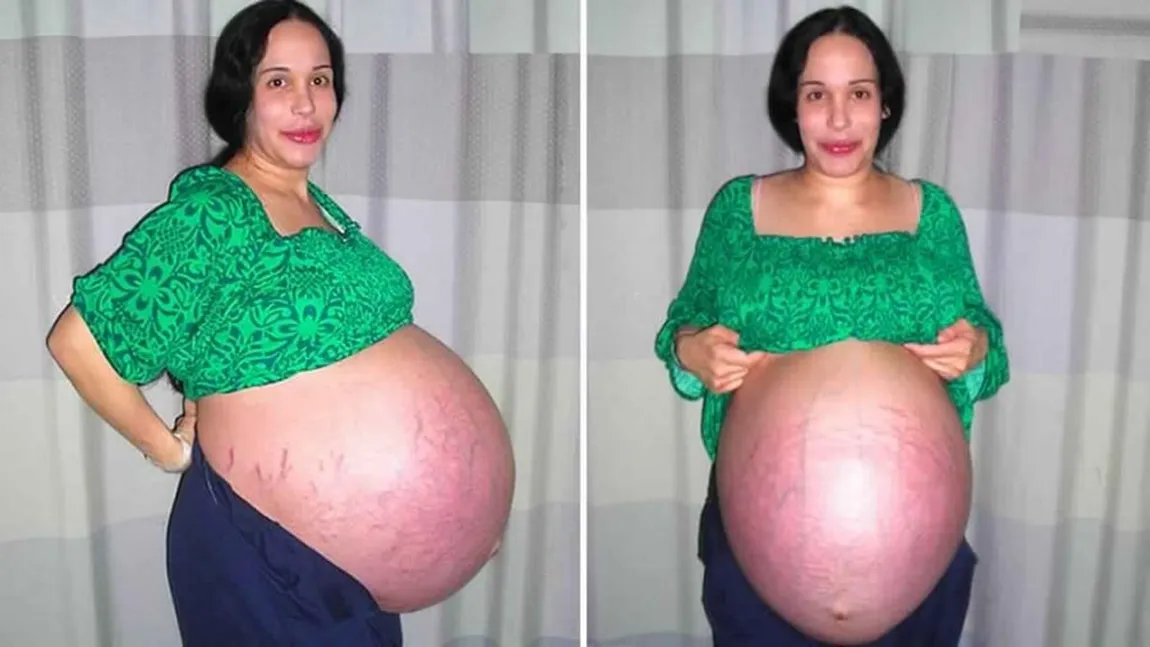 Vă mai amintiţi de Nadya Suleman, femeia însărcinată cu 8 copii? Cum arată acum, la 11 ani după ce a născut