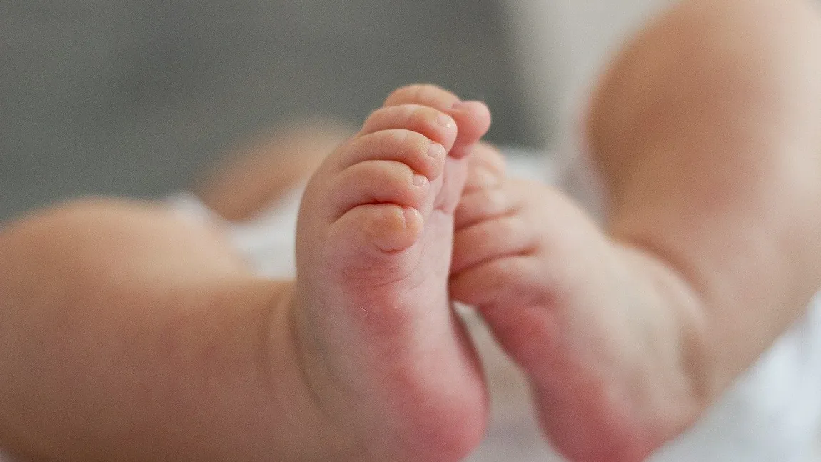 Bebeluş cu două capete, născut într-un spital din Bucureşti. Caz rar în România