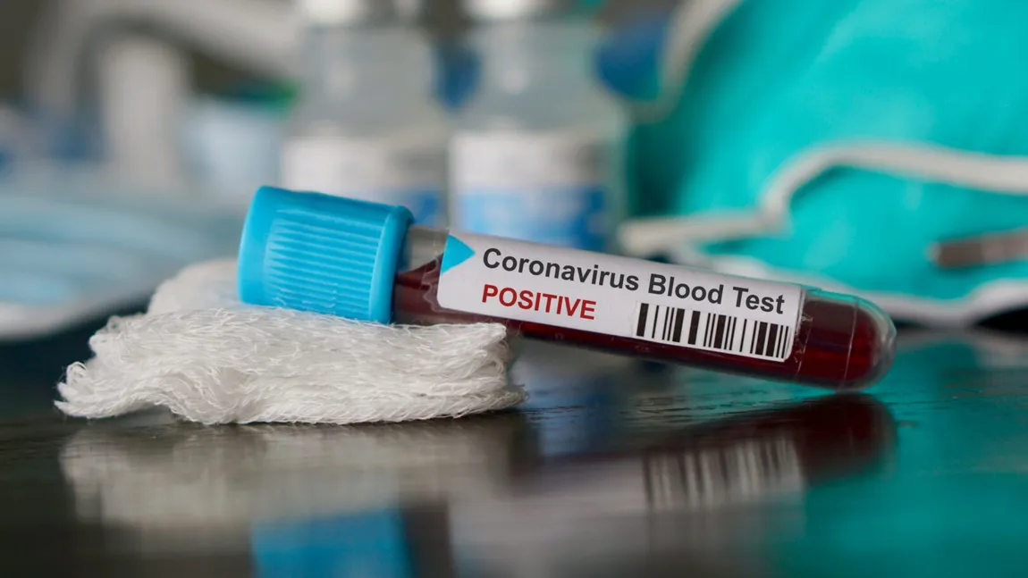 Bilanţ coronavirus 23 ianuarie. Peste 2.700 de cazuri noi COVID în 24 de ore. Doar doua judeţe mai sunt în scenariul roşu