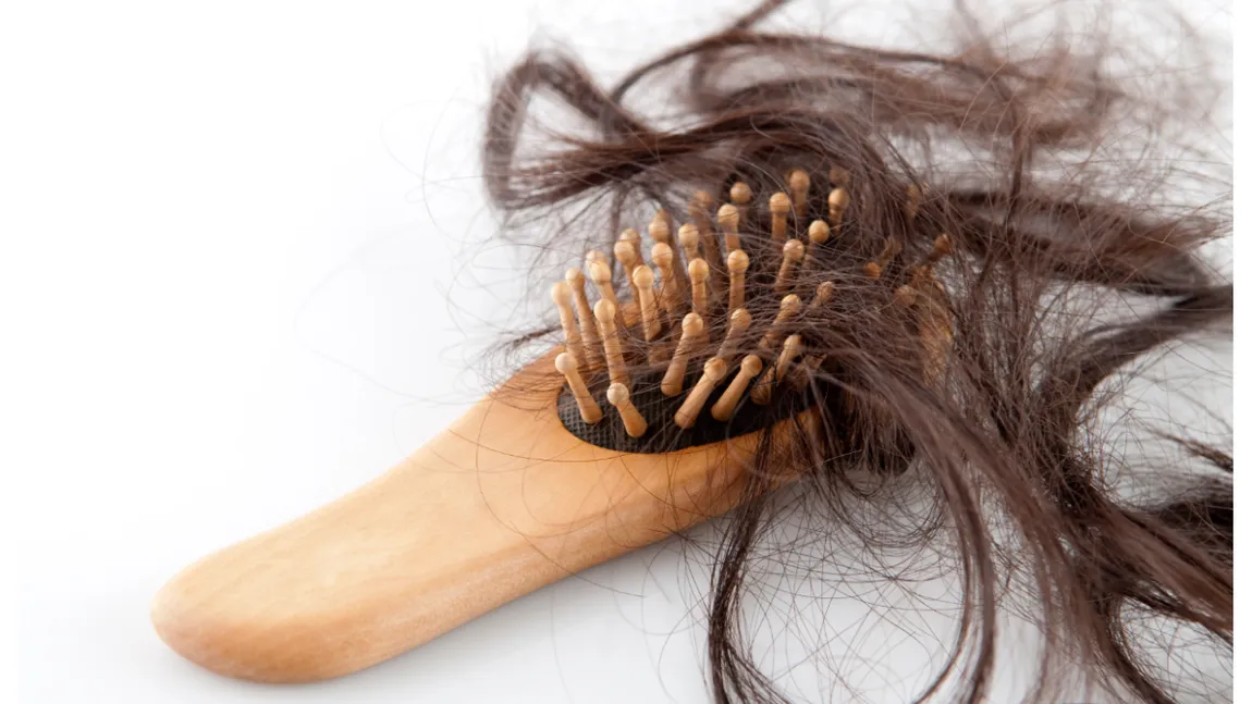 Efecte adverse cumplite ale coronavirusului. O femeie şi-a pierdut părul.