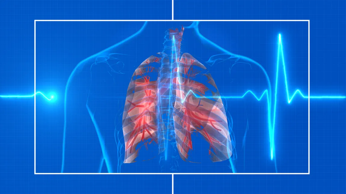 Primul caz de Covid transmis prin transplant de organe. O femeie a murit după ce a primit plămâni infectaţi cu coronavirus