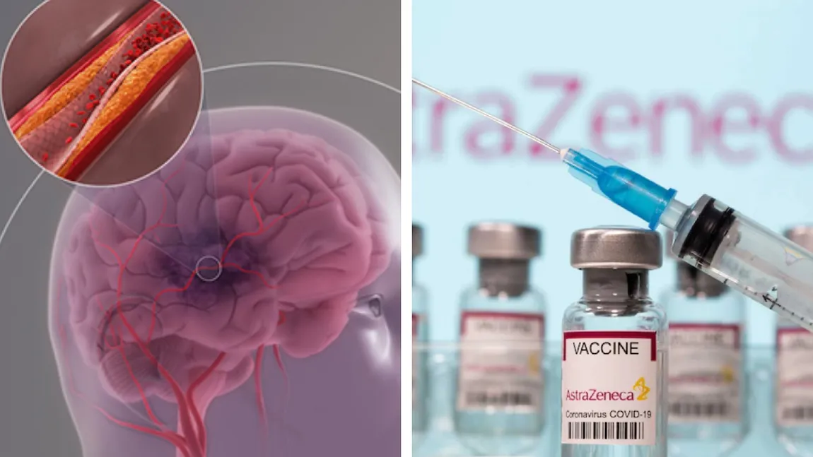 Care este, de fapt, legătura dintre vaccinul Astra Zeneca şi apariţia cheagurilor de sânge