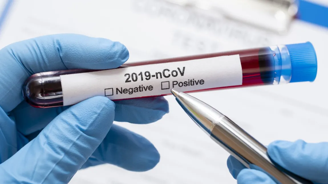 Bilanţ coronavirus 3 martie. Aproape 4.300 de cazuri noi. Cinci judeţe, în scenariul roşu