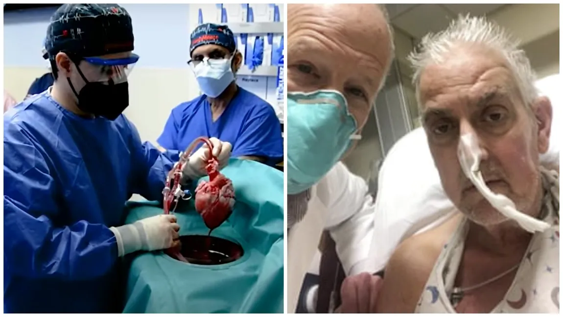 PREMIERĂ MEDICALĂ. O inimă de porc a fost transplantată unui om. Intervenția a salvat viața pacientului VIDEO