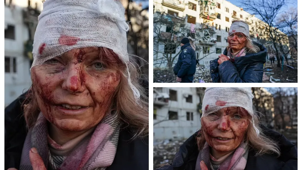 Femeia din Ucraina, a cărei poză face înconjurul lumii, şi-a spus povestea: 