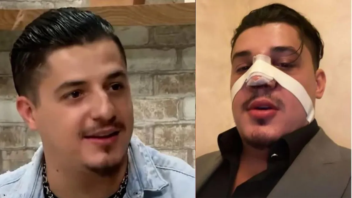 Bogdan de la Ploiești a apărut cu nasul bandajat pe aeroport. Ce a pățit celebrul manelist VIDEO