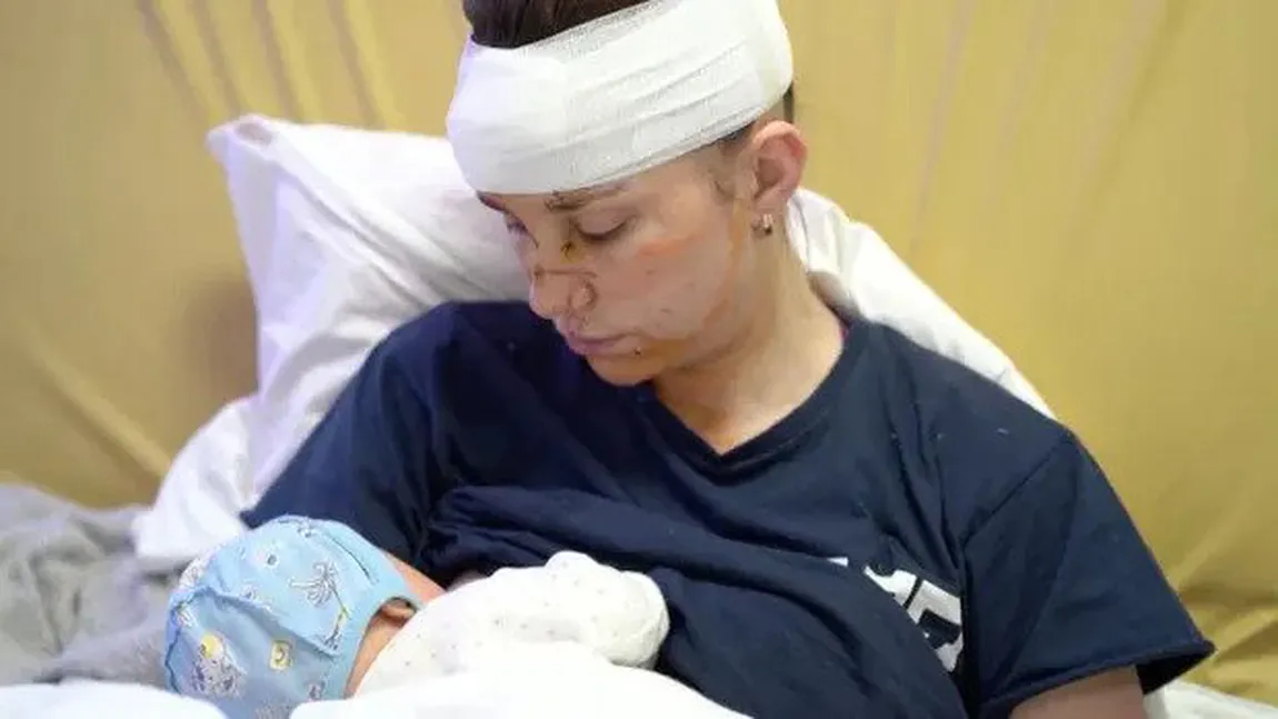 Mamă ucraineană plină de schije şi răni, după ce şi-a apărat bebeluşul cu propriul trup, de atacurile ruşilor. 
