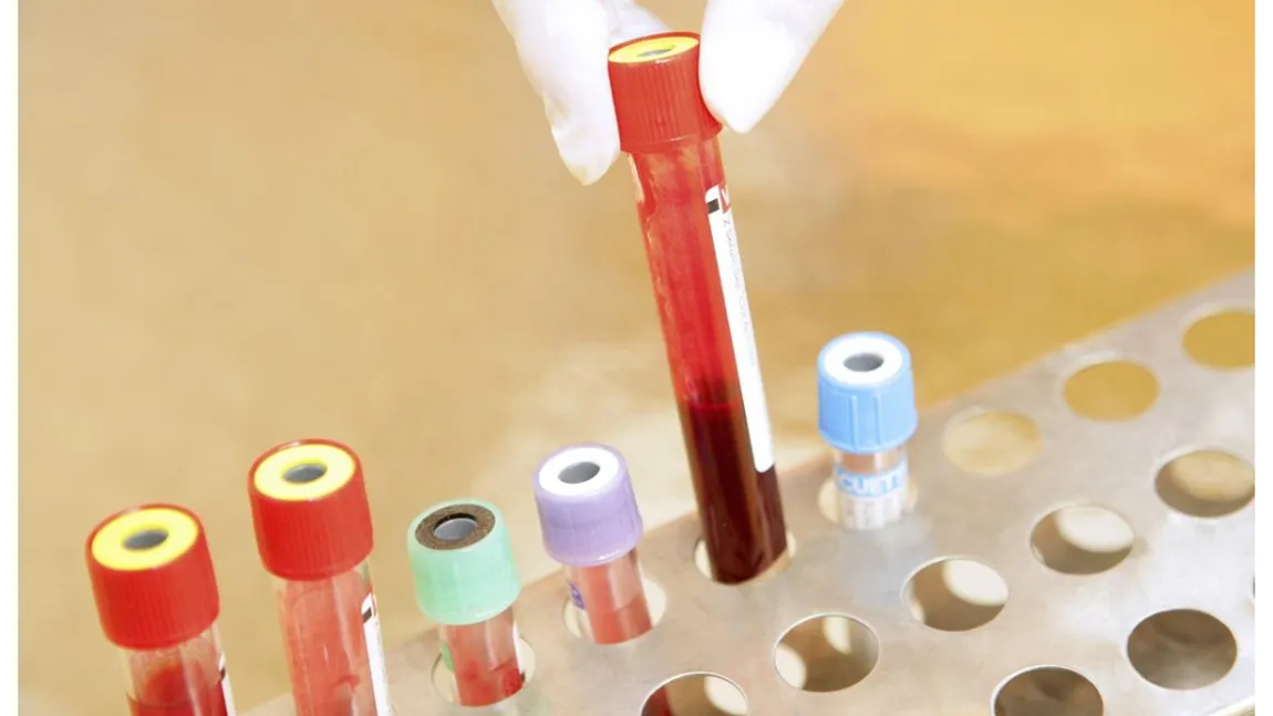 Microparticule de plastic, găsite în sângele uman. Descoperirea uluitoare a oamenilor de ştiinţă