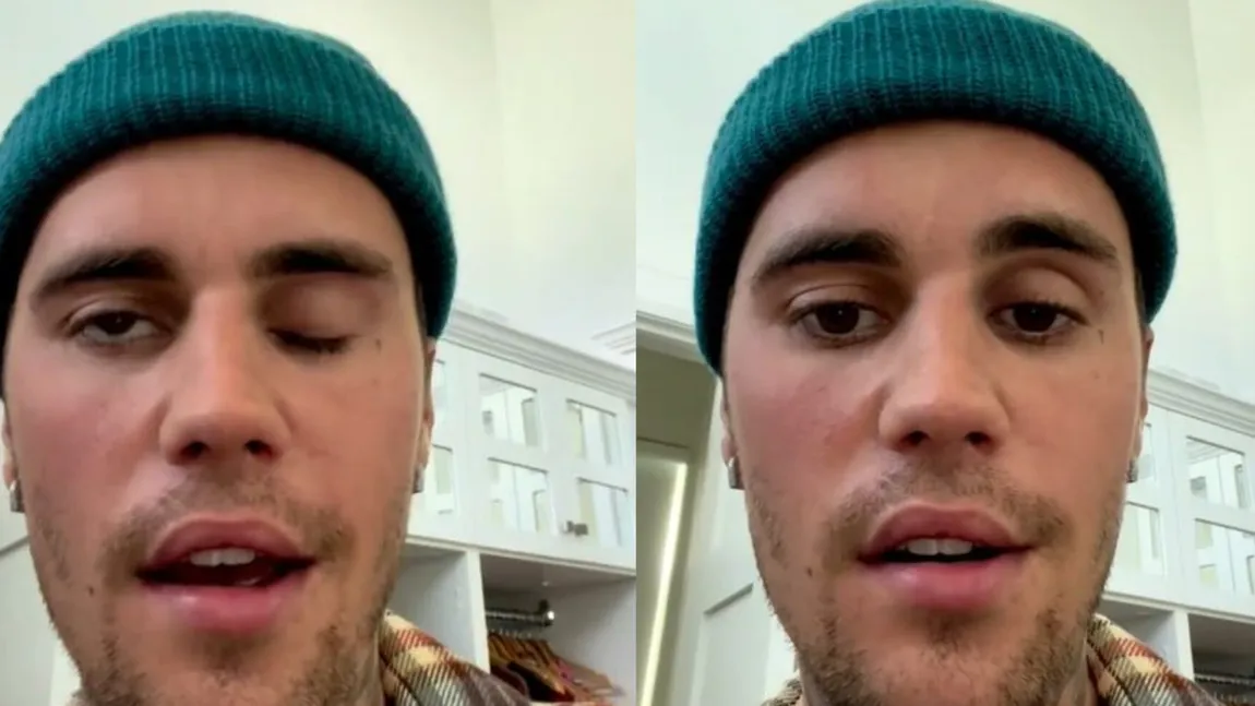VIDEO VIRAL. Justin Bieber anunță că suferă de o boală teribilă. Fața artistului a paralizat
