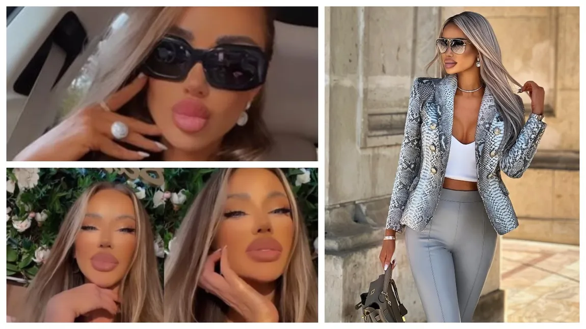 Bianca Drăgușanu și-a jignit fanele de pe Instagram. S-a săturat să i se spună că are buze prea mari