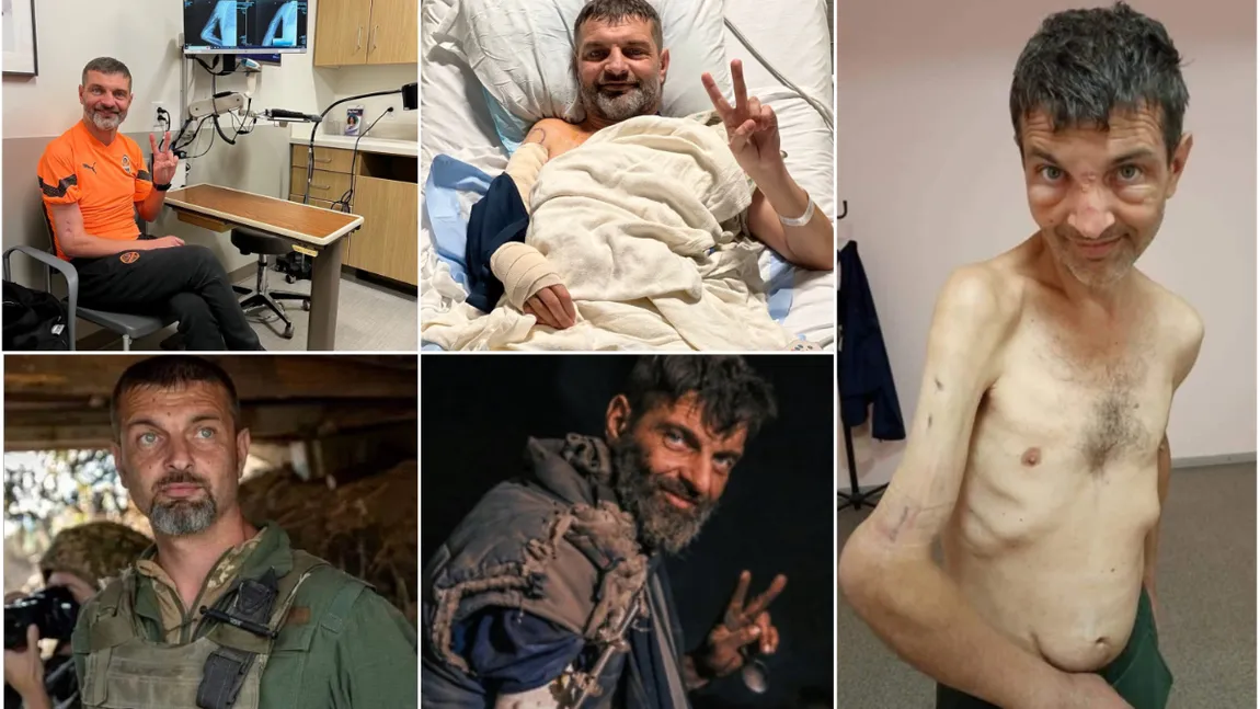 Cum arată acum Mihailo Dianov, eroul de la Azovstal! Militarul ucrainean a fost torturat de ruși cât timp l-au ținut prizonier