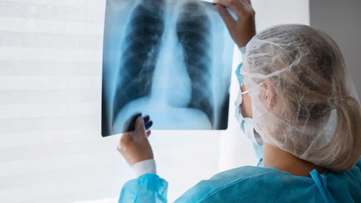 Sindromul plămânului alb, maladia care a ajuns din China în Europa. Pneumonia misterioasă care a pus pe jar lumea medicală