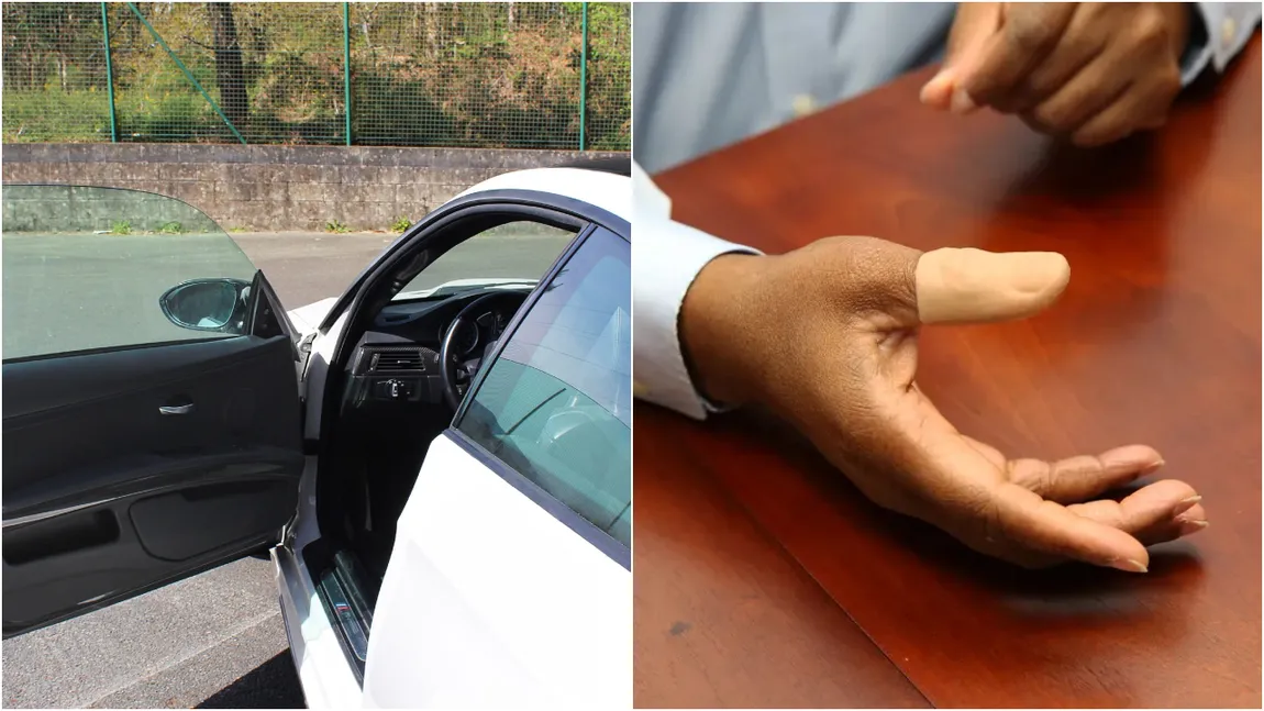 Un bărbat s-a îmbogățit peste noapte! Suma pe care a primit-o de la BMW pentru că și-a prins degetul în portieră