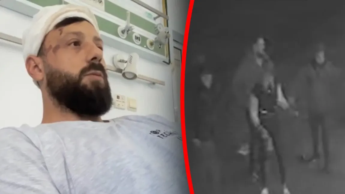 Scene de groază în Militari Residence. Un tânăr a fost schingiuit cu un ciocan și lăsat inconștient de 8 bărbați. Agresorii sunt căutați în continuare