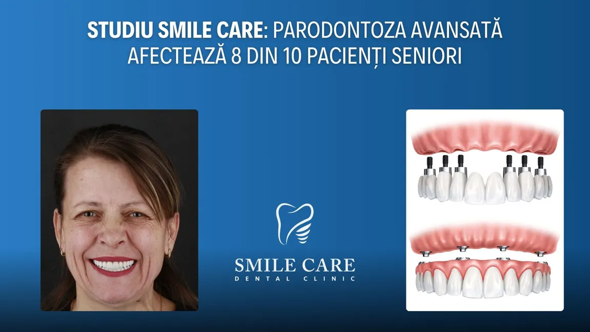 Studiu SMILE CARE: Parodontoza avansată afectează 8 din 10 pacienți seniori, iar proteza fixă pe implanturi oferă o soluție durabilă și estetică