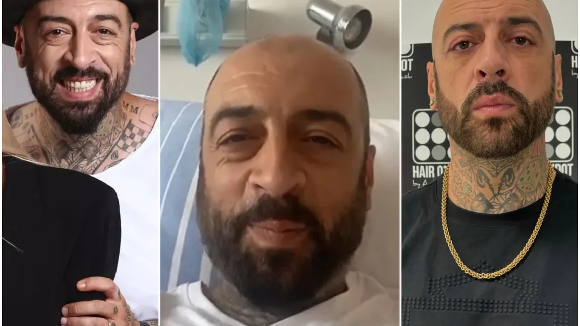 După ce și-a făcut blefaroplastie, CRBL a apelat la încă o procedură estetică: 