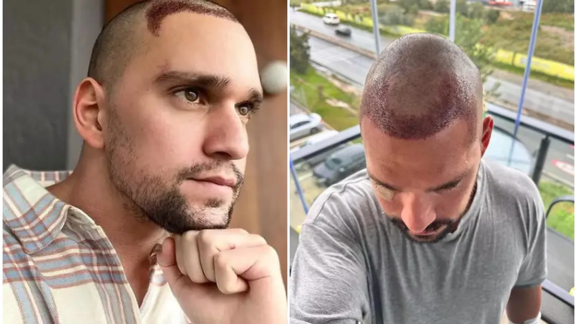 Vlad Gherman, la prima apariție publică după intervențiile de implant de păr. A ajuns de nerecunoscut FOTO