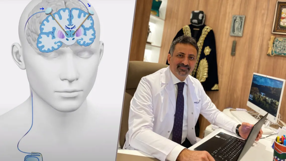 Stimularea profundă a creierului, o soluție inovatoare pentru pacienții români cu boala Parkinson