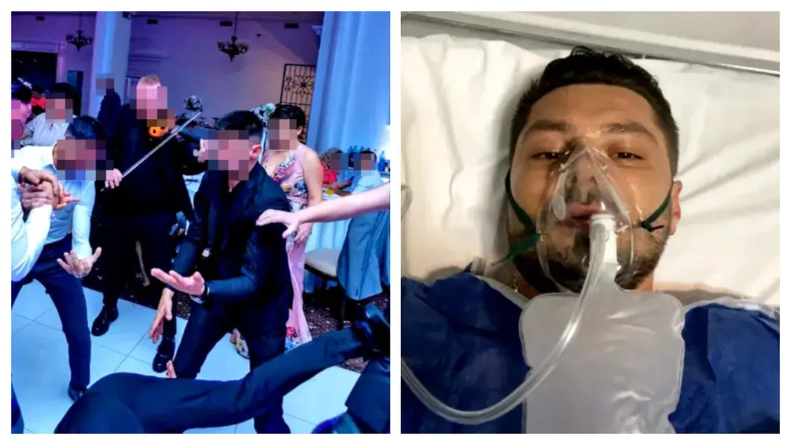 Mirele scăpat din brațe de prieteni la nuntă s-a întâlnit pentru prima oară de la incident cu cei care l-au nenorocit pe viață: ”Se uitau cu scârbă la mine”
