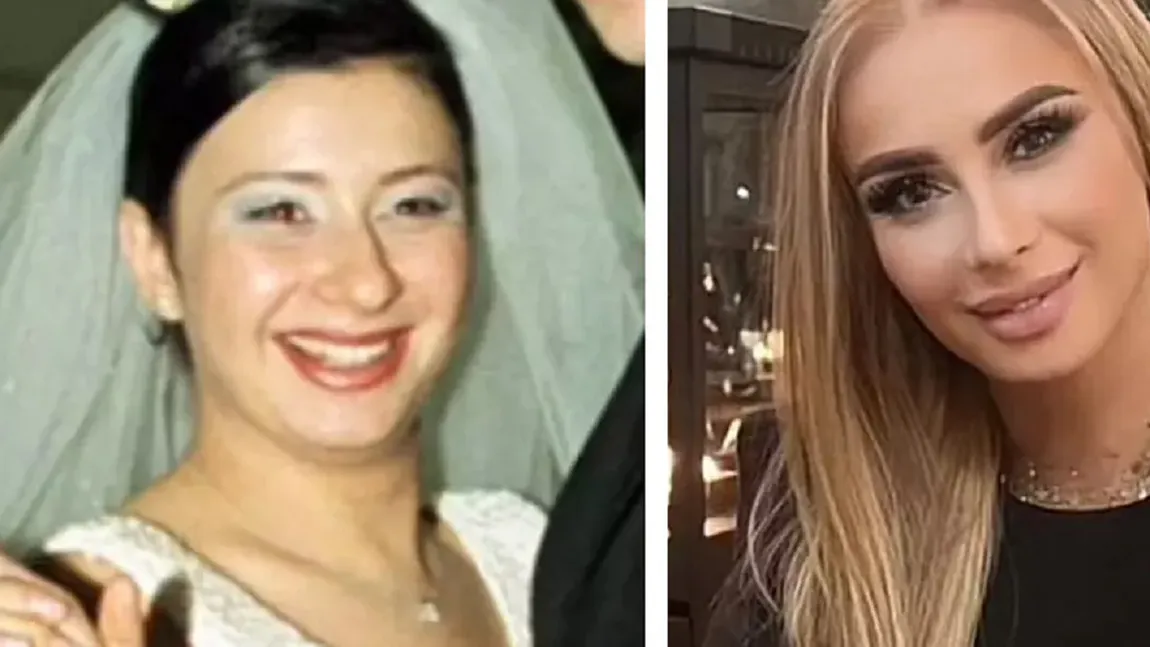 Anamaria Prodan rupe tăcerea despre operaţiile estetice. Ce nu ar accepta niciodată să-şi facă la faţă