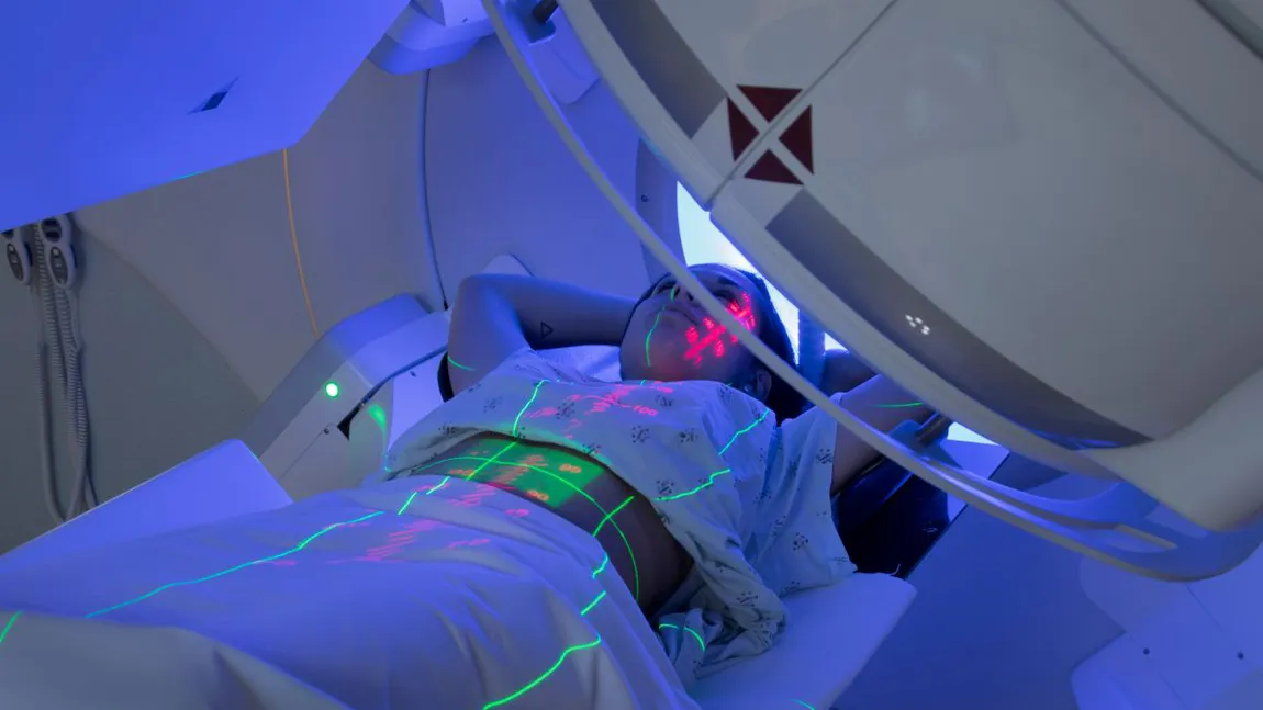 Tratament de ultimă generaţie în oncologie: radioterapia stereotaxică. Dr Irinel Popescu: 