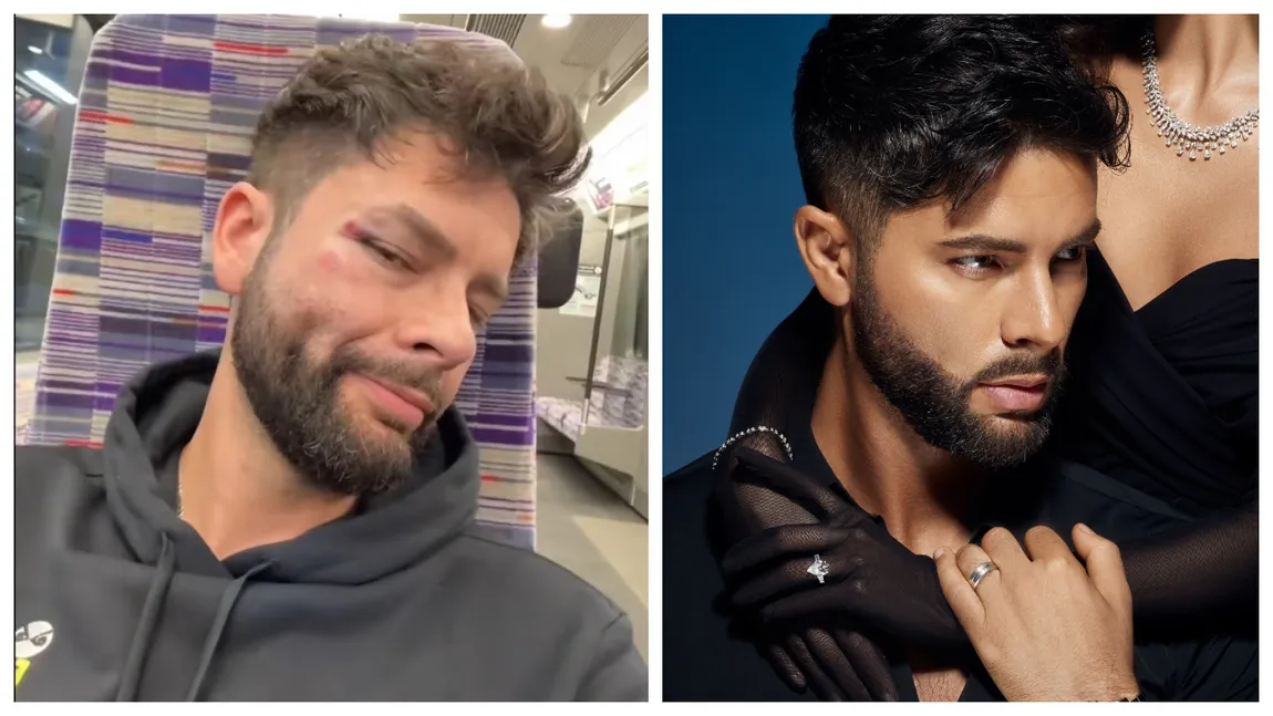 Șocant! Andrei Vasile de la Insula Iubirii a fost bătut și jefuit în plină stradă, la Londra! ”A vrut să mă înjunghie” VIDEO