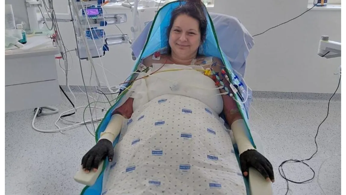 Noi detalii despre pacienta cu arsuri infectată la Floreasca și transferată în Belgia. Sora ei anunță progrese incredibile: ”Paşi mici, dar extrem de importanţi”
