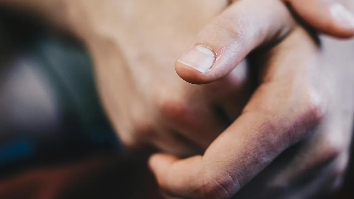 Suferi de anxietate generată de psoriazis? Tratamentul care te ajută să îți recapeți sănătatea fizică și psihică există