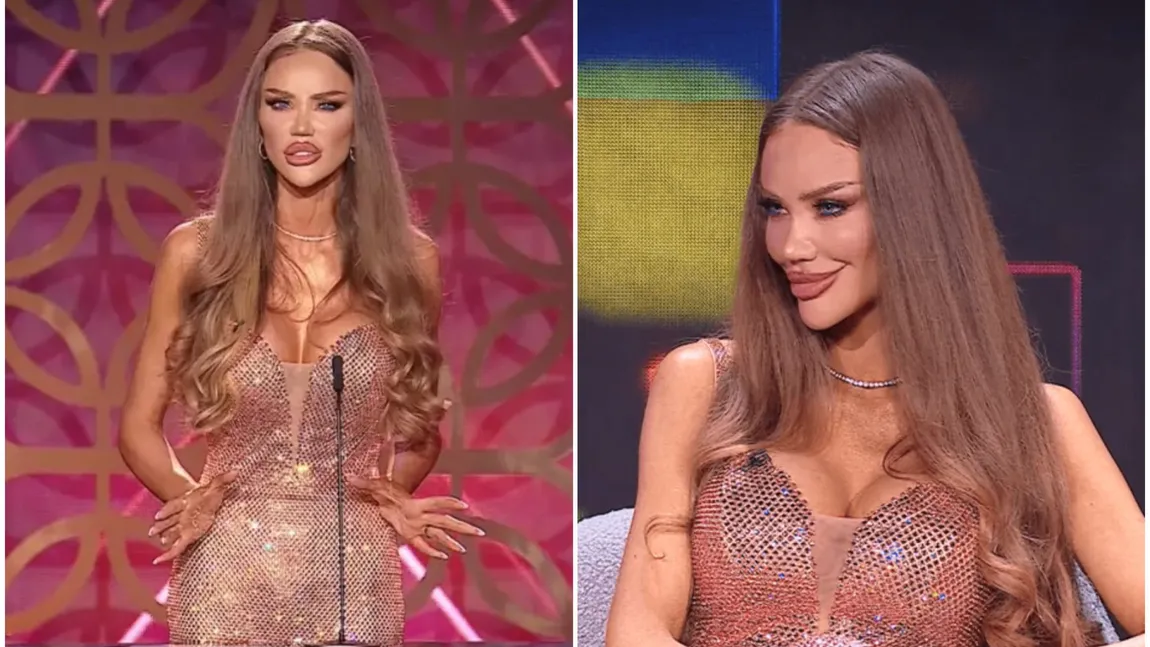 Bianca Drăgușanu, schimbată complet la față. Motivul pentru care are bărbia atât de ascuțită: 