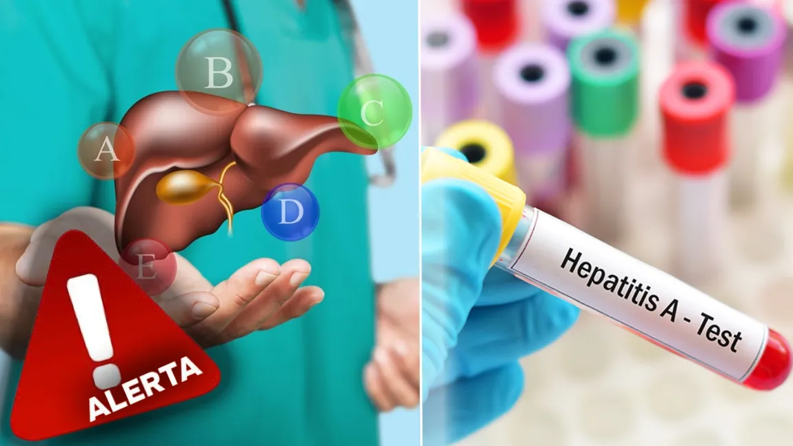 Alertă sanitară în România! 7 focare de hepatita A, depistate în mai multe localități din țară