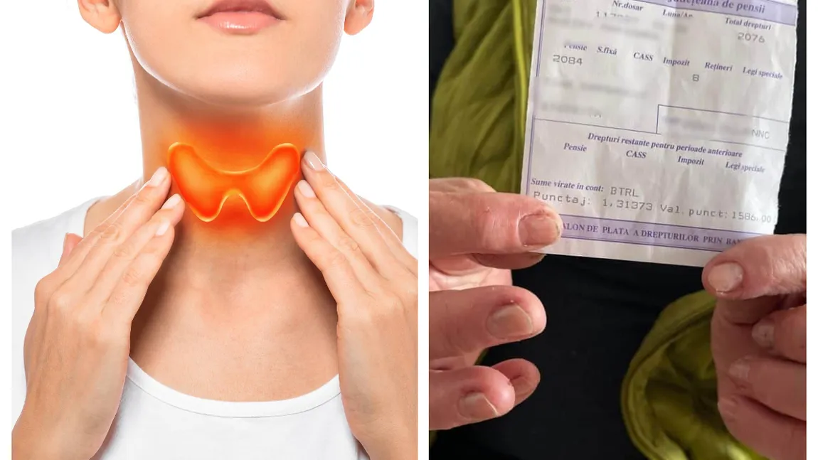 În ce condiții poate obține pensie de handicap românii cu tiroidă autoimună. Ce spune legea