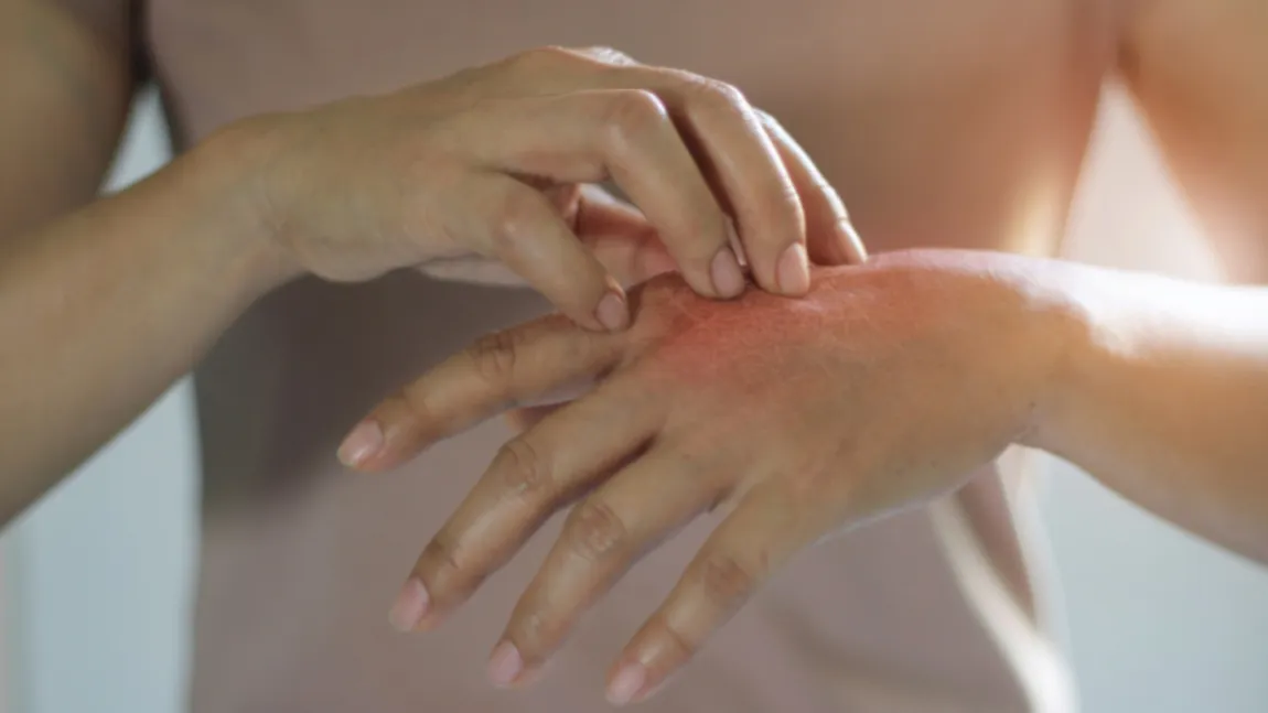 Încă două femei au ajuns la spital cu suspiciune de infecție cu lepră. Anunțul făcut de Ministerul Sănătății