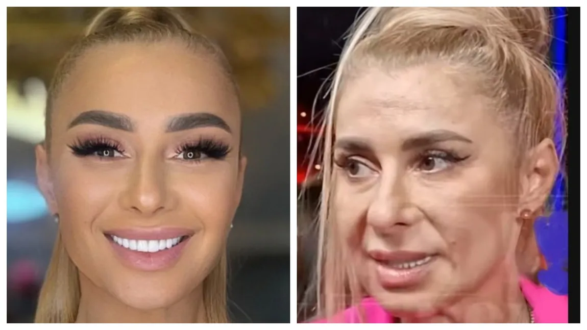 Câte operaţii estetice are, de fapt, Anamaria Prodan. 