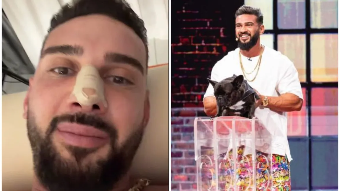 Cum arată nasul lui Dorian Popa după operație. Influencerul și-a dat bandajele jos: 