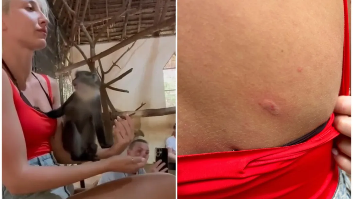 Monica Odagiu, mușcată de maimuță în vacanță: 