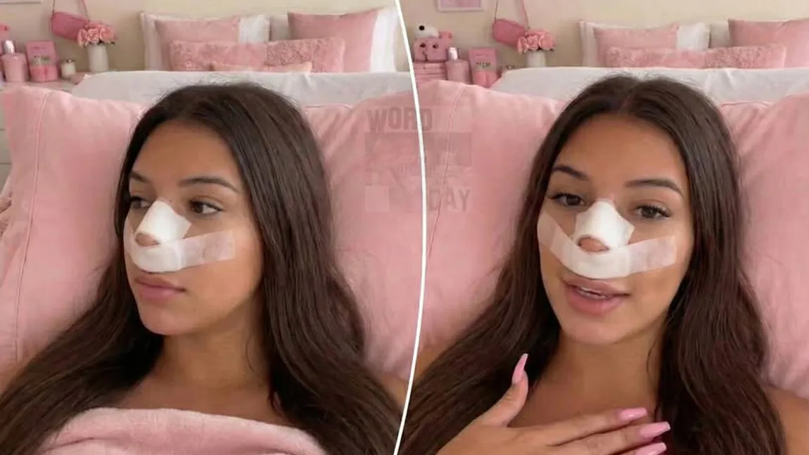 O influenceriță de pe Instagram și TikTok s-a operat pentru ca viitorii copii să nu îi moștenească nasul: „Nu vreau ca ei să crească fiind hărțuiți așa cum am fost eu în copilărie”