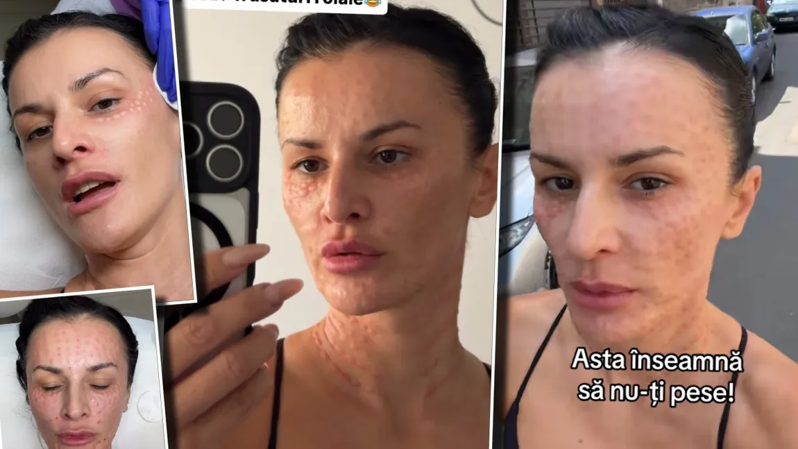 Influencerița Rux și Opulență, apariție șocantă pe stradă după un tratament facial de ultimă generație: 