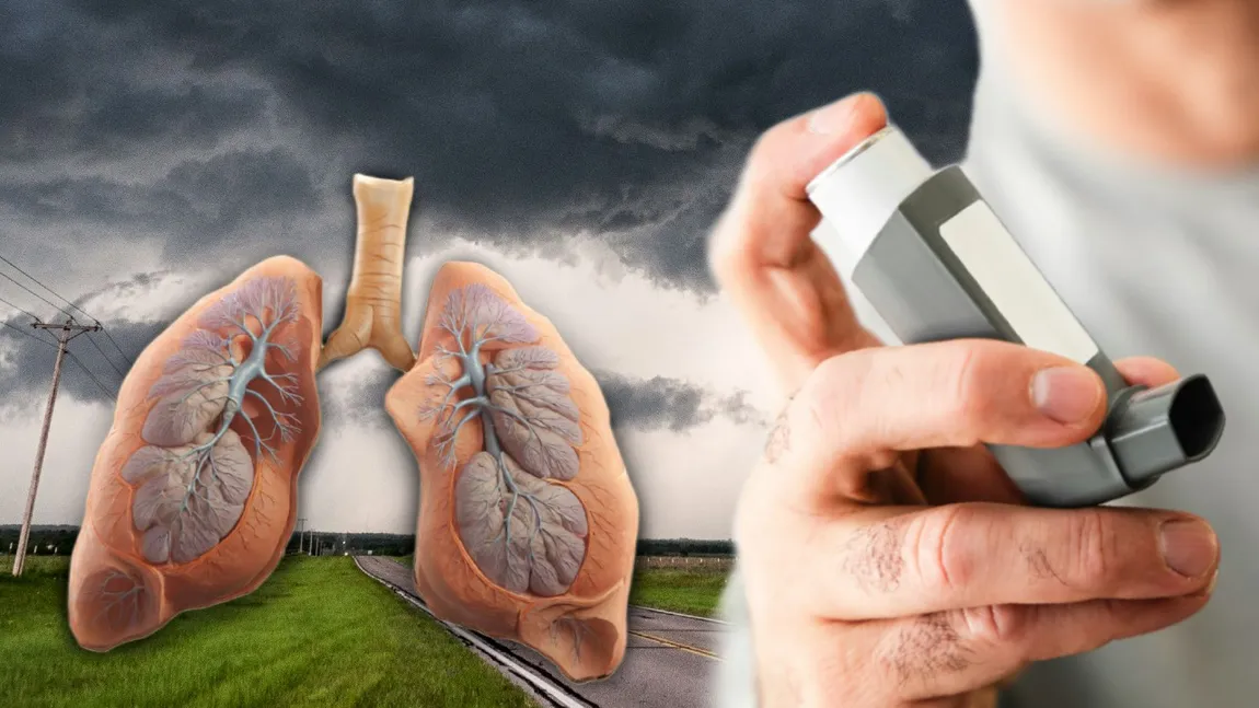 Ce este astmul de furtună. Fenomenul respirator favorizat de schimbările climatice bruște