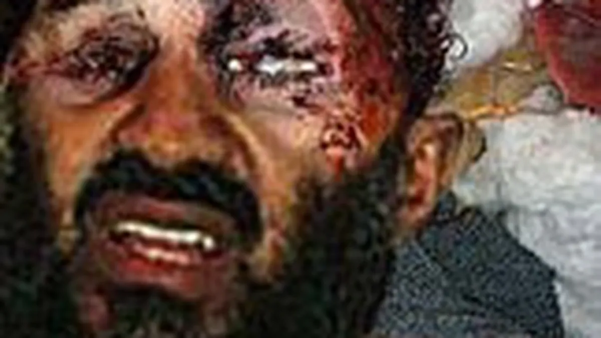 Fotografia cadavrului lui Osama bin Laden este trucata