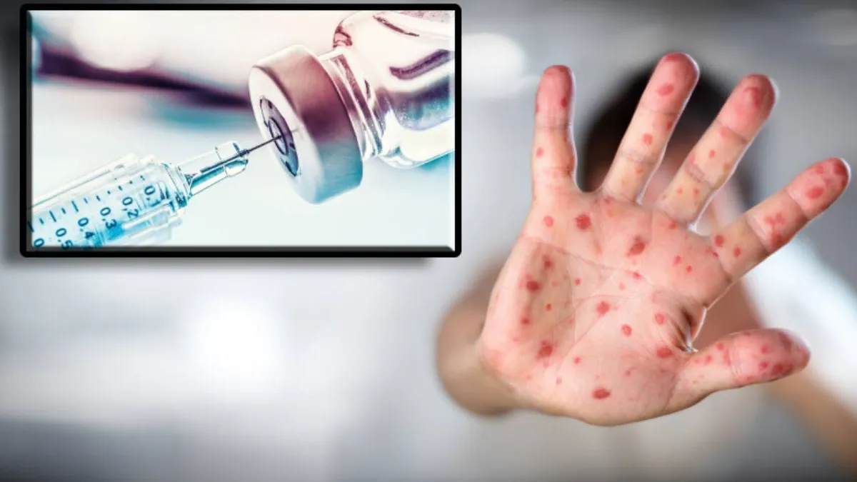 Se iau măsuri la nivel național din cauza epidemiei de rujeolă! Ministerul Sănătății a declarat epidemie la nivel național!