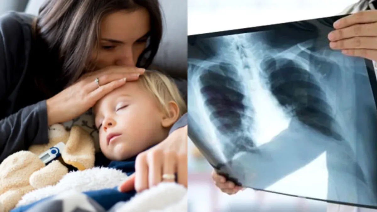 România, în topul deceselor cauzate de afecțiuni respiratorii!