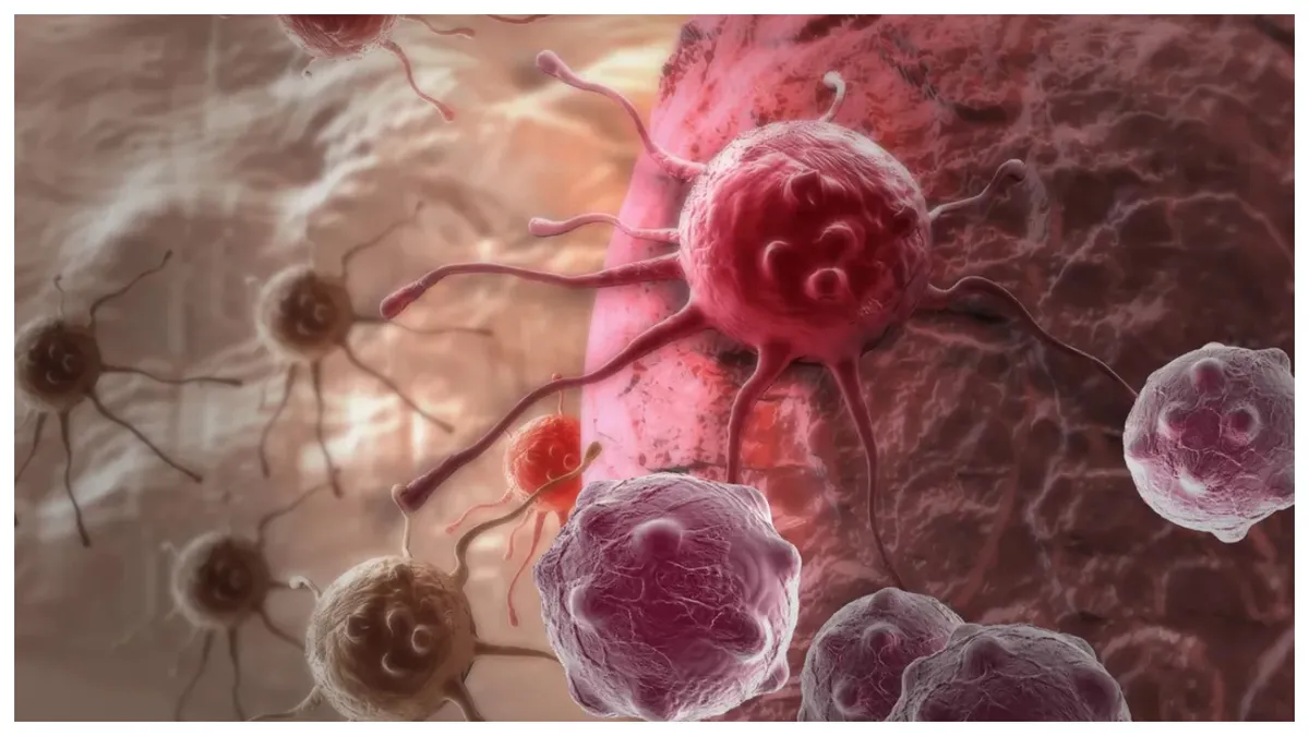 Alimentul care reduce drastic riscul de cancer de colon și scade inflamația în întreg corpul