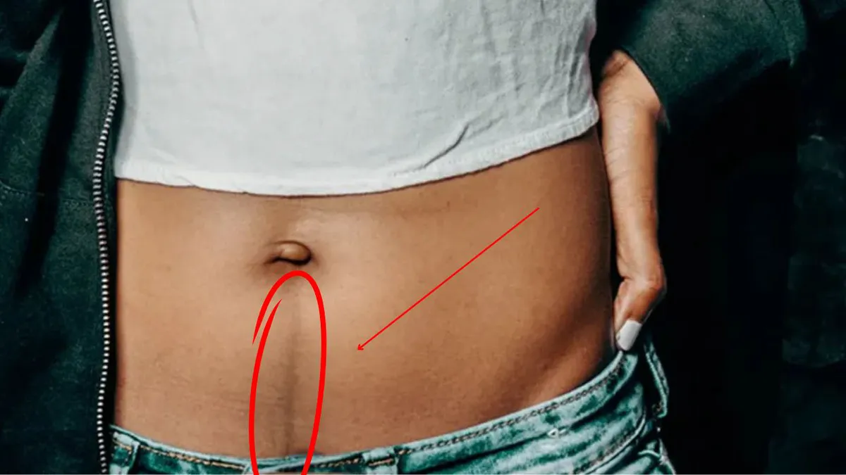 Linea nigra, linia secretă care apare pe abdomen în timpul sarcinii și nu doar