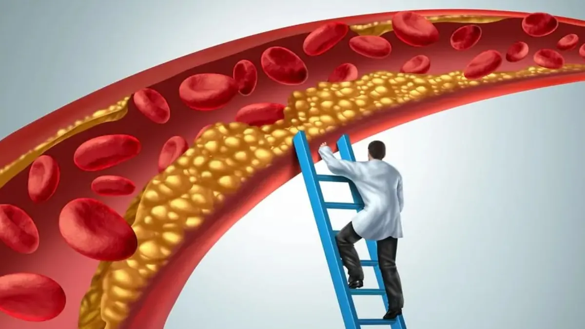 Cum poți afla dacă ai colesterolul mărit, fără analize de sânge. Indiciile de pe corp care ți-ar putea salva viața