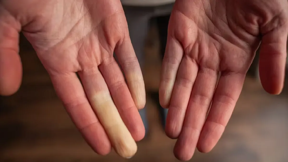 Probleme de sănătate cu care te poți confrunta dacă ai mâinile reci