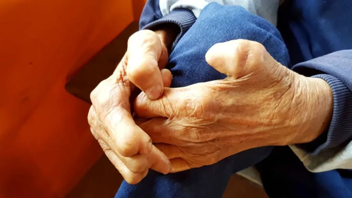 Ministrul Sănătății liniștește populația după cazul de lepră de la Cluj: „Nu există risc pentru clienții salonului”