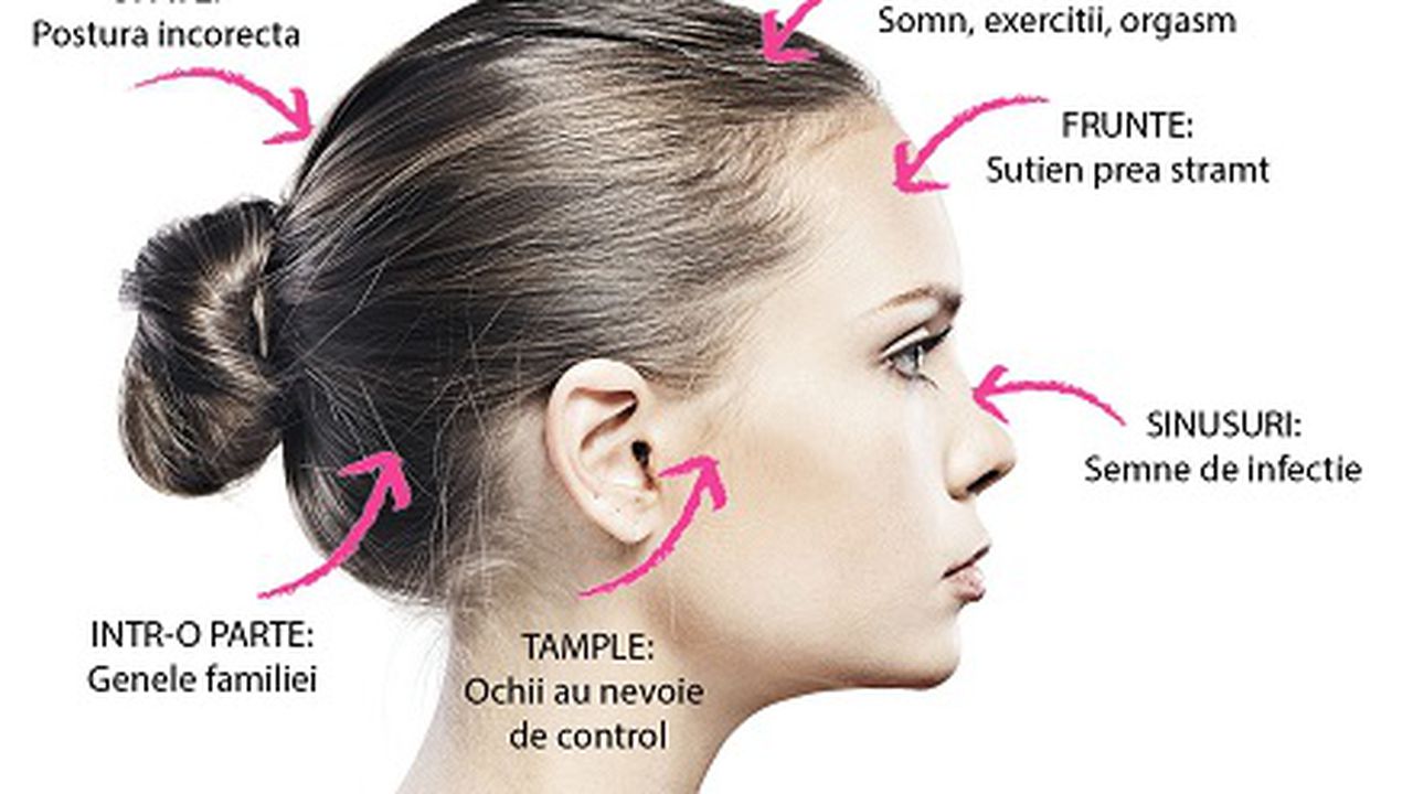 Tipuri De Dureri De Cap Ce IndicÄƒ Durerea De Cap In FuncÅ£ie De Zona In Care