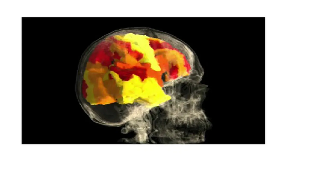 Cum arată creierul unei femei în timpul orgasmului