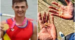 Suferinţa din spatele performanţei! Imagine șocantă cu mâinile canotorului Ciprian Tudosă, câștigătorul medaliei de argint de la JO 2020