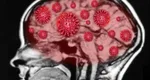 Anticorpi „defecţi” ar putea afecta creierul tinerilor, în timpul infecţiei cu Covid. Ei dezvoltă paranoia, delir şi gânduri suicidare